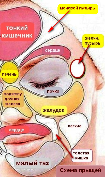Когда угри на лице что означают Когда угри на лице что означают