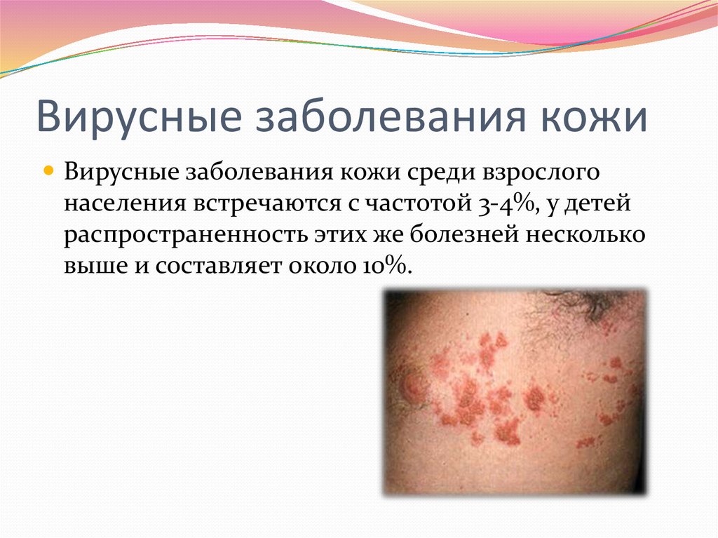 Гепатит с и заболевания кожи Гепатит с и заболевания кожи