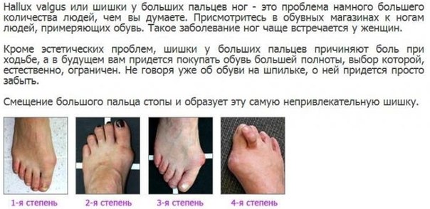 Котлы - где купить по выгодным ценам. Характеристики