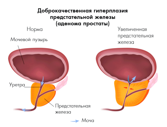 Какого размера простата в норме Какого размера простата в норме