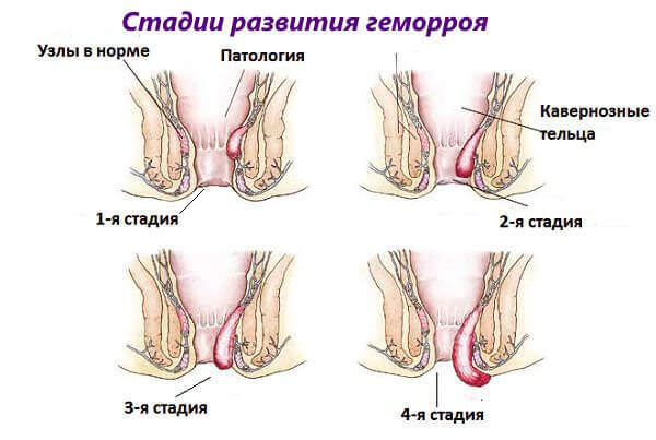 Журналы по вязанию палантина Журналы по вязанию палантина
