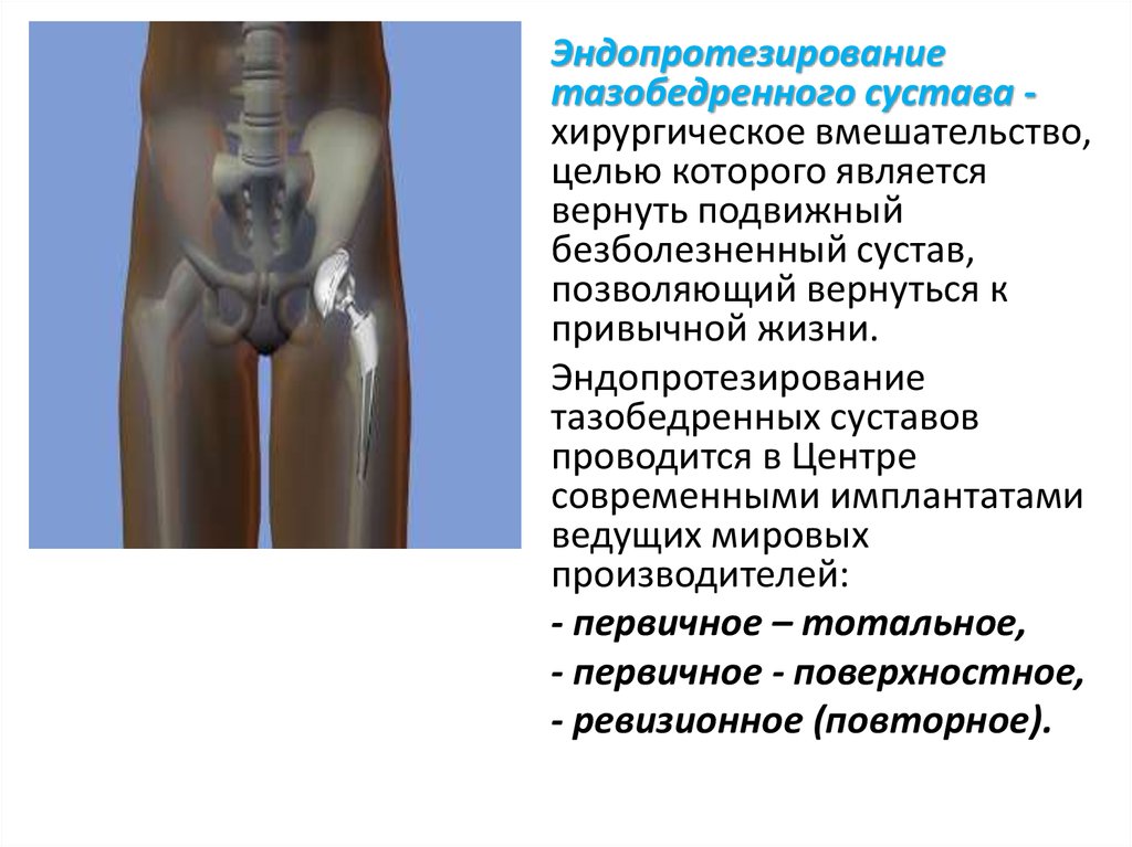 Позы после эндопротезирования тазобедренного сустава Позы после эндопротезирования тазобедренного сустава