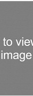 Hairy teens vigrin hiry Video on male masturbation