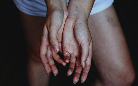 «Любовь рассасывается вместе с синяками»: истории жертв домашнего насилия